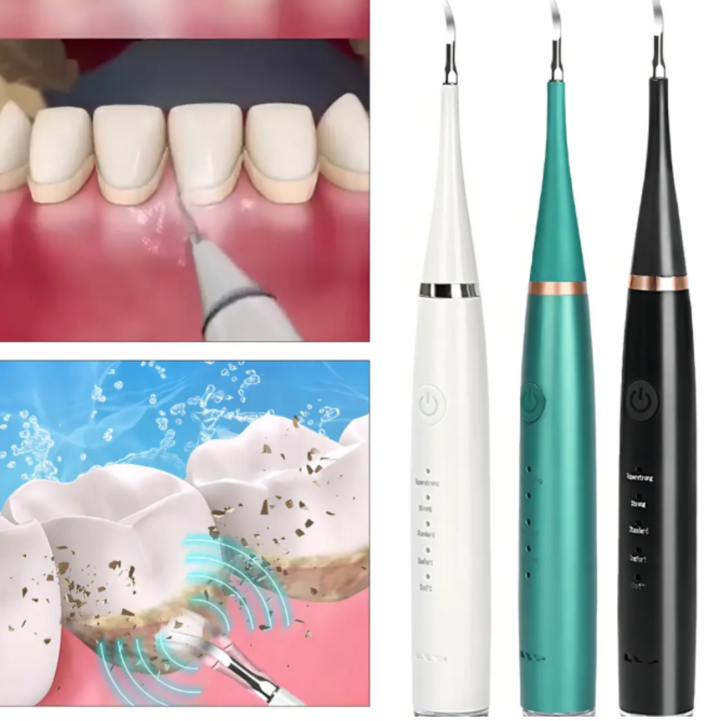 UltraDent Pro Tecnología Sónica Anti-Sarro