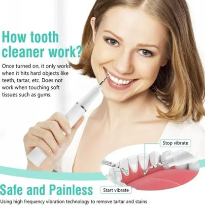 UltraDent Pro Tecnología Sónica Anti-Sarro